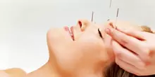 acupuntura estética